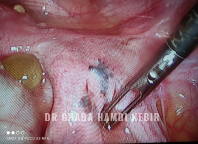 Capture d’écran 2025-01-23 195026