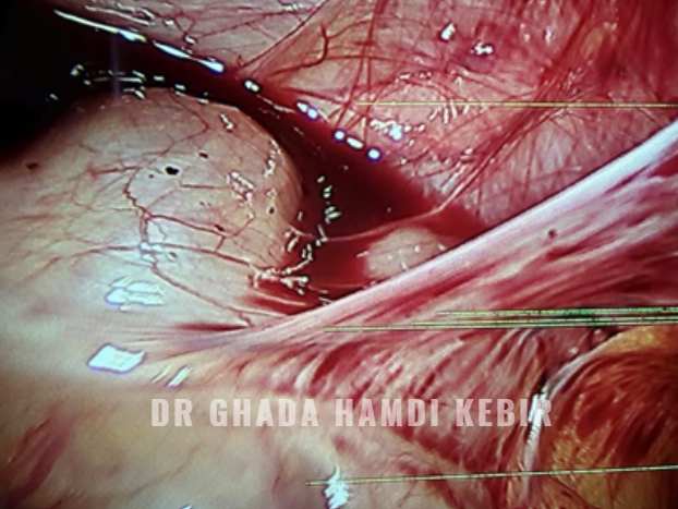 Capture d’écran 2025-01-23 195058