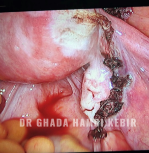 Capture d’écran 2025-01-23 205955