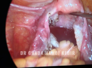 Capture d’écran 2025-01-23 210234